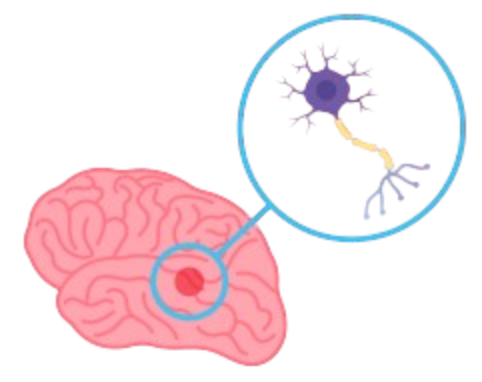 Nervous System Disorders and Spinal Cord